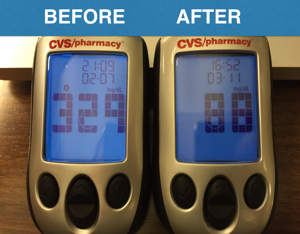 20150314sa-glucose-reading-blood-sugar-over-300-before-after-IMG_0078-1024x800